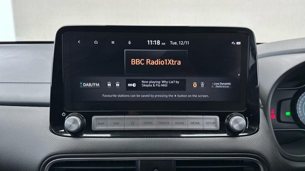 DAB Radio