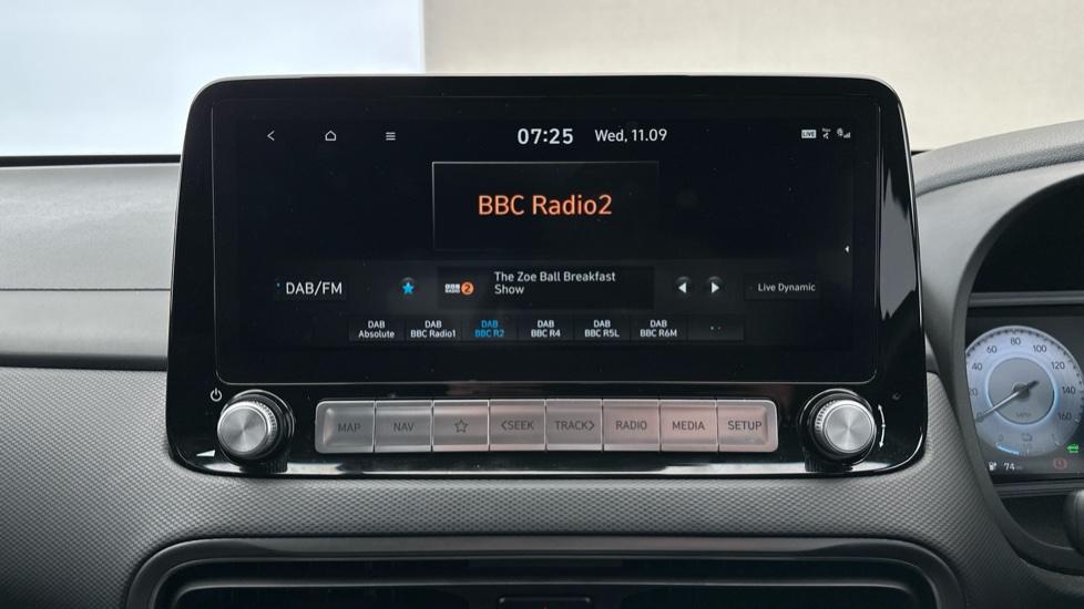 DAB Radio