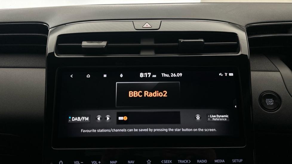 DAB Radio