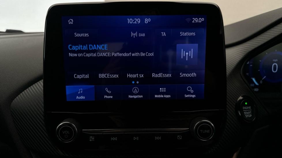 DAB Radio