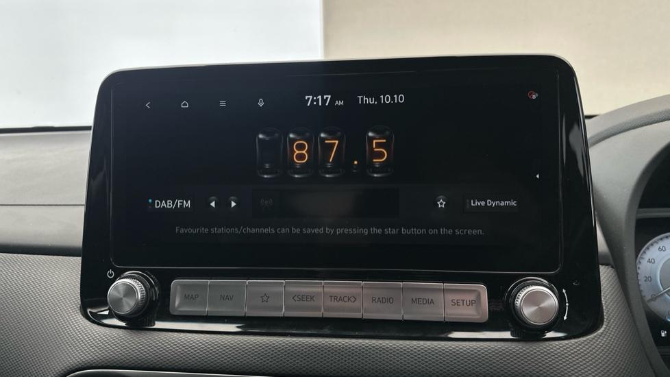 DAB Radio