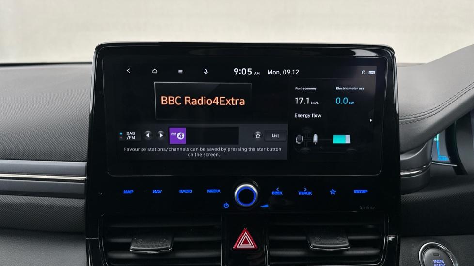 DAB Radio