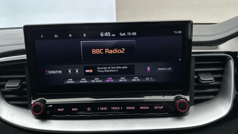 DAB Radio