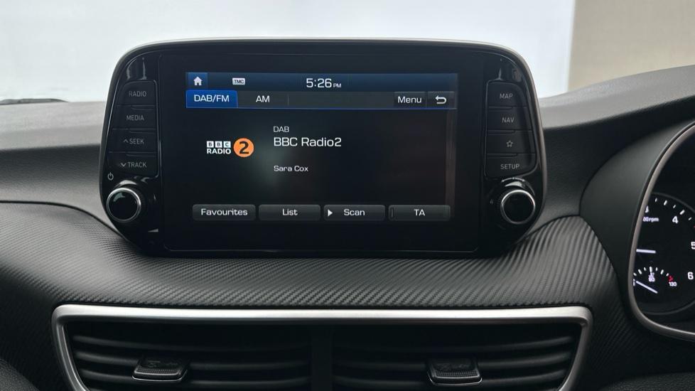 DAB Radio