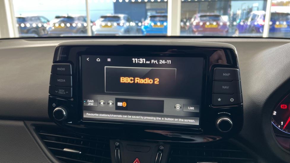 DAB Radio