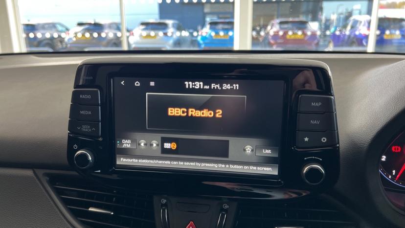 DAB Radio