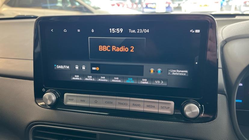 DAB Radio