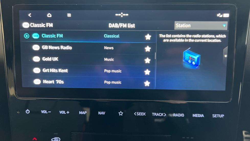 DAB Radio