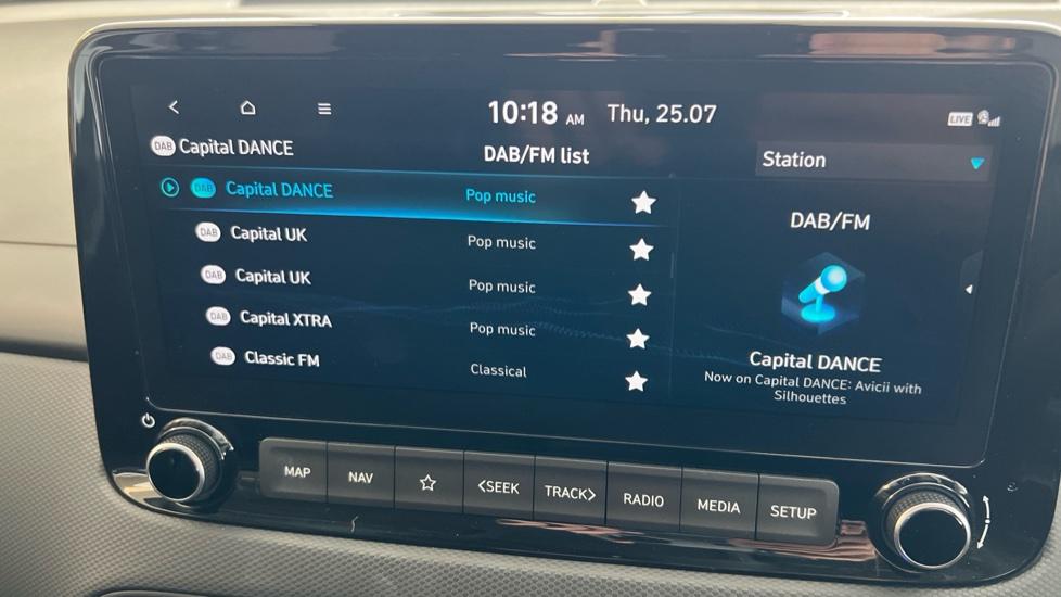 DAB Radio