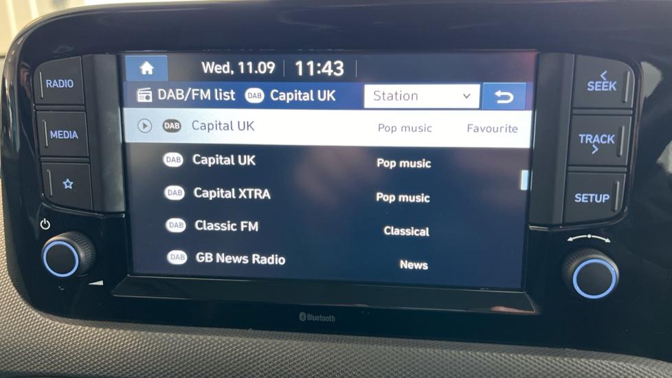 DAB Radio