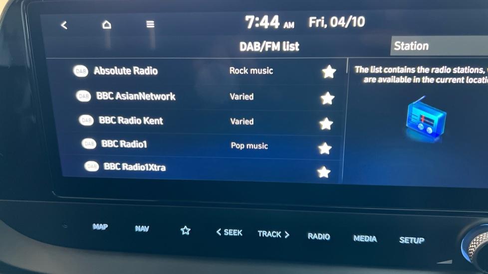 DAB Radio