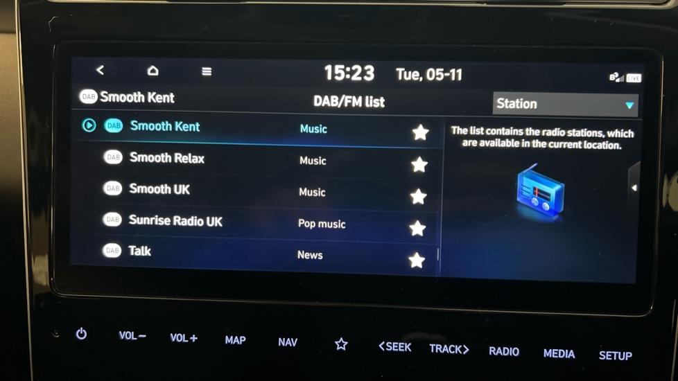 DAB Radio