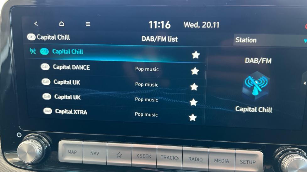 DAB Radio