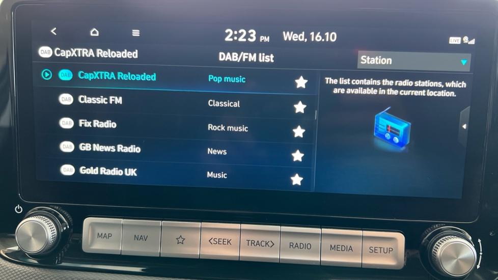 DAB Radio