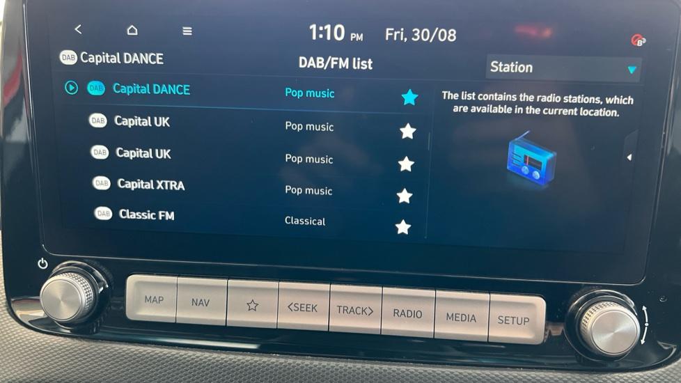 DAB Radio