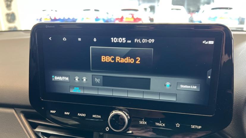 DAB Radio