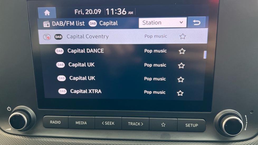 DAB Radio