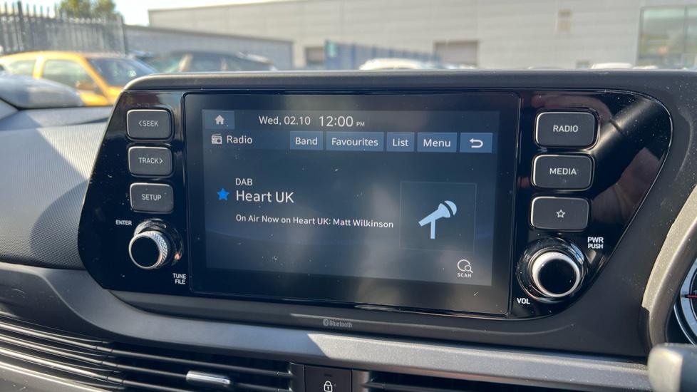 DAB Radio