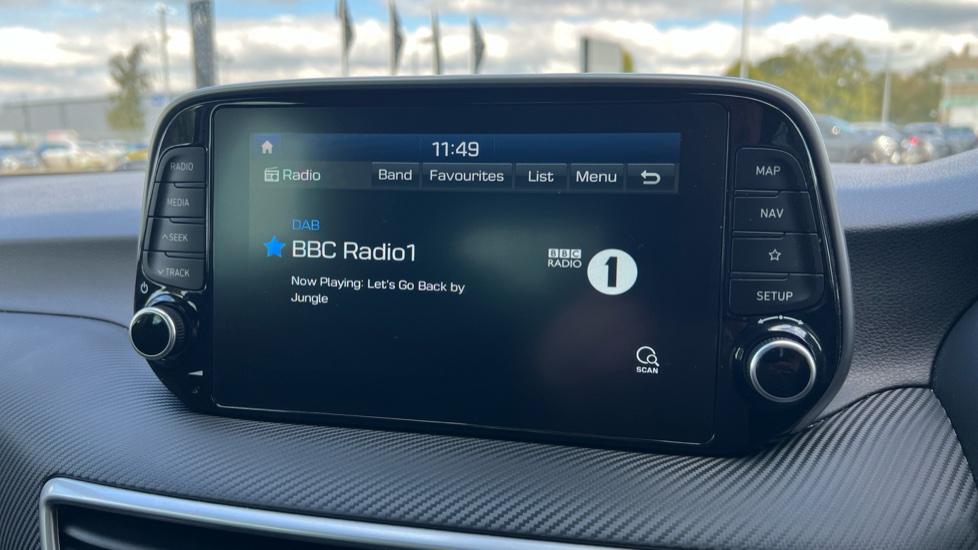 DAB Radio