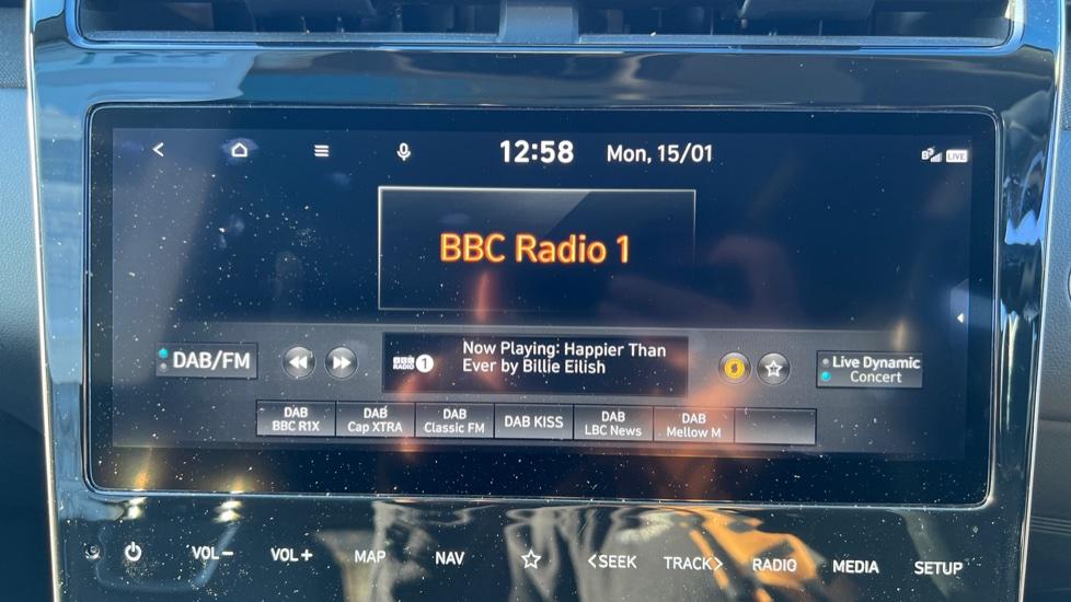 DAB Radio