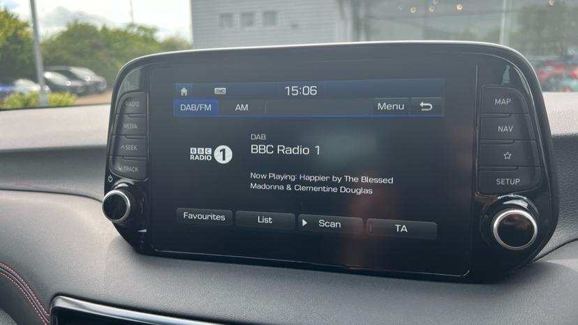 DAB Radio