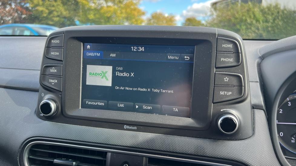 DAB Radio