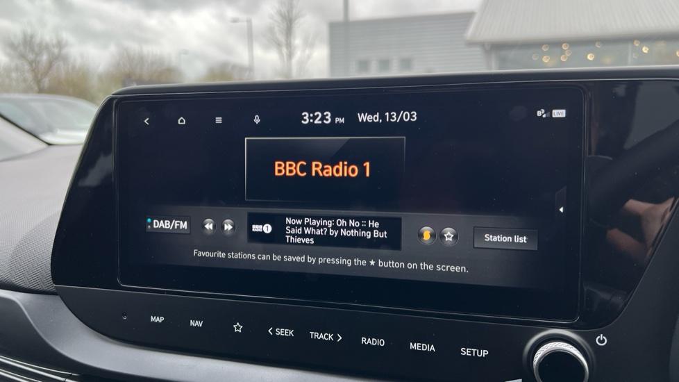 DAB Radio