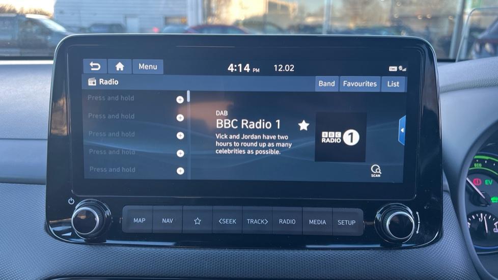 DAB Radio