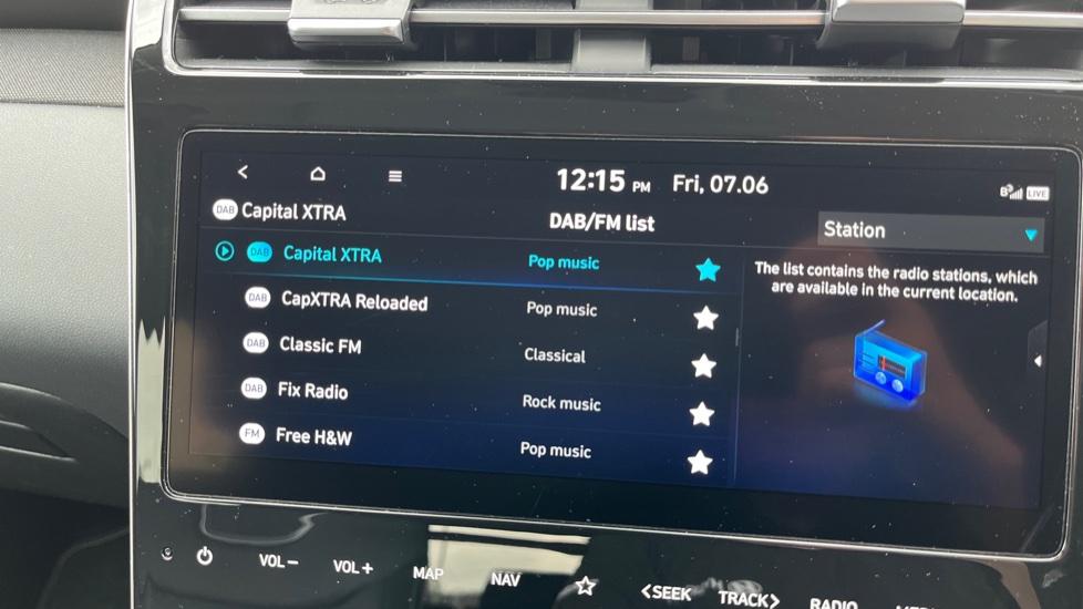 DAB Radio