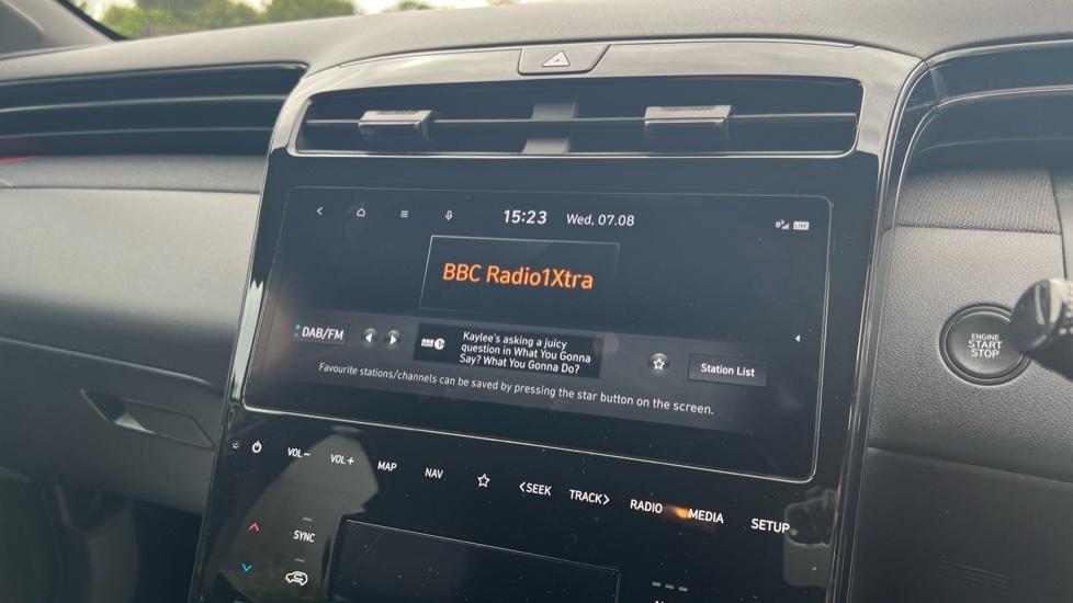 DAB Radio