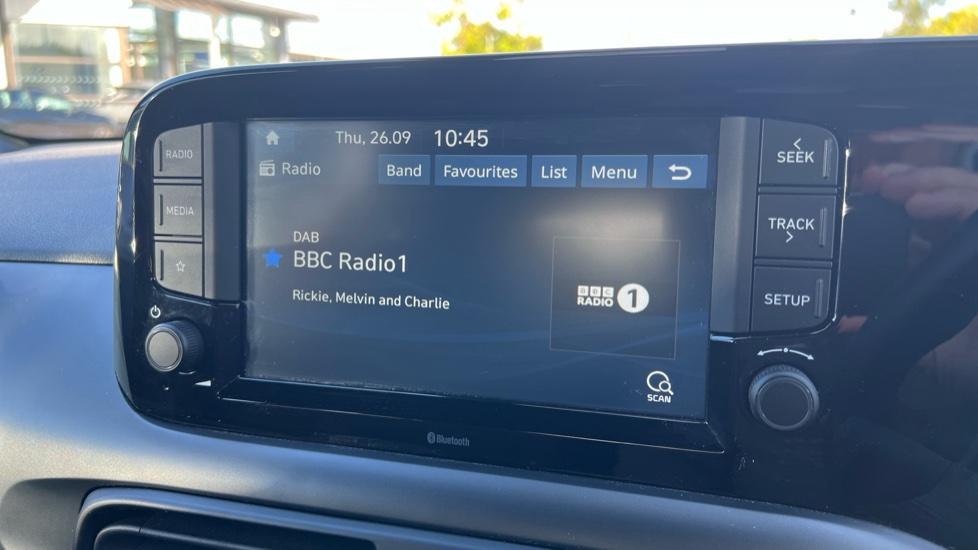 DAB Radio