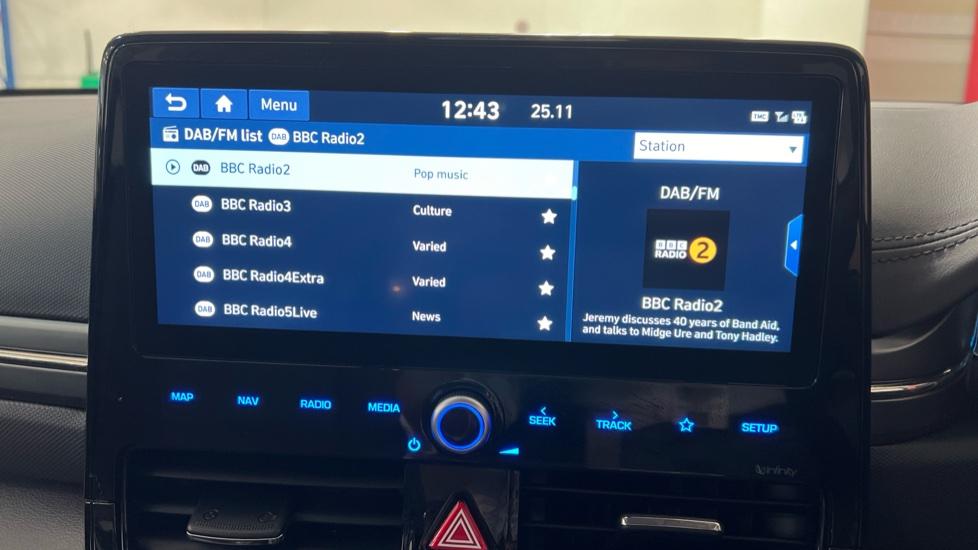 DAB Radio