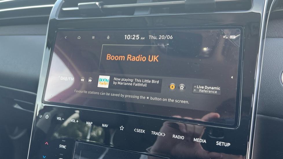 DAB Radio