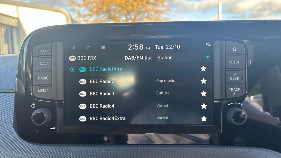 DAB Radio