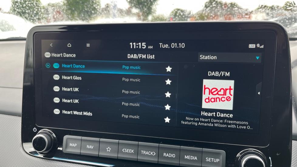 DAB Radio