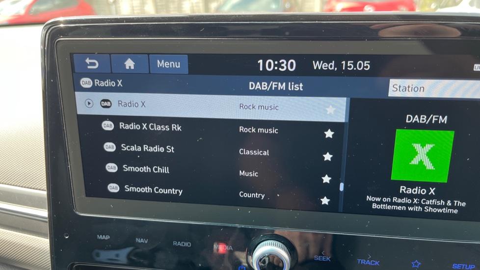 DAB Radio