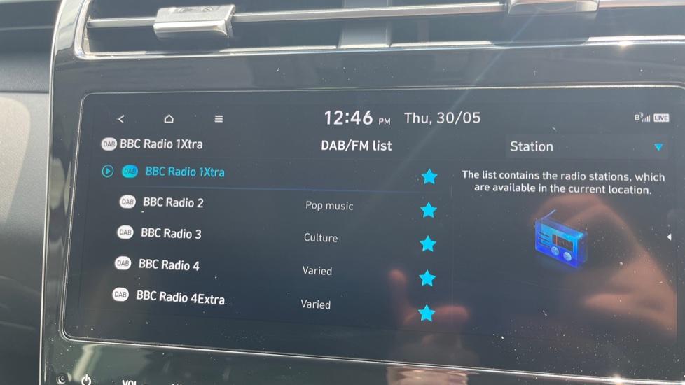 DAB Radio