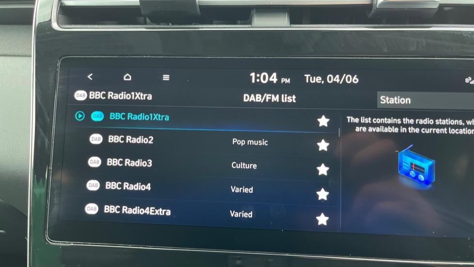 DAB Radio