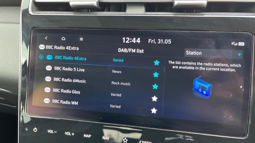 DAB Radio