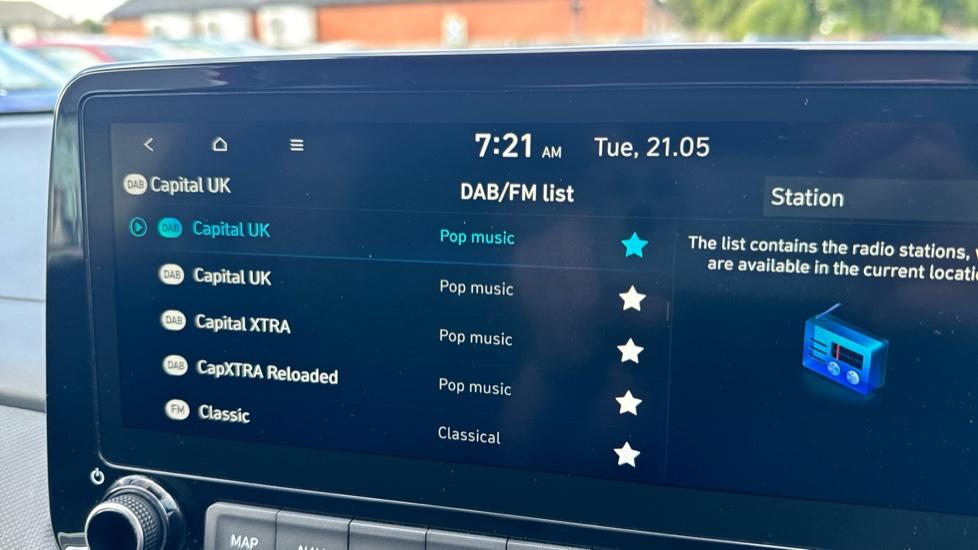 DAB Radio