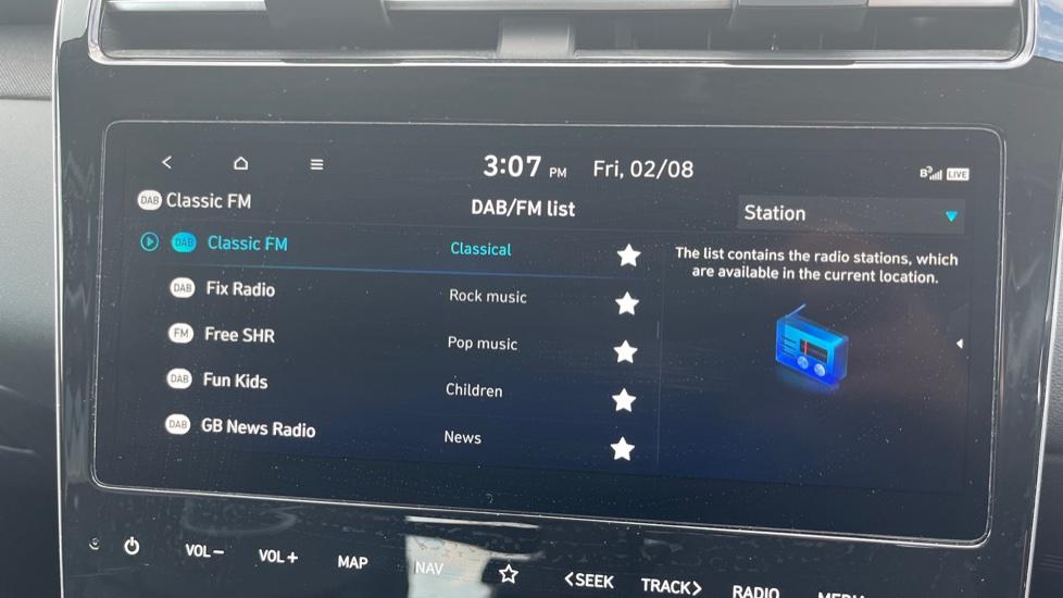 DAB Radio