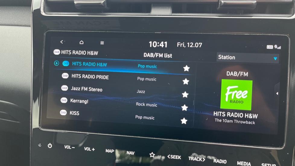 DAB Radio