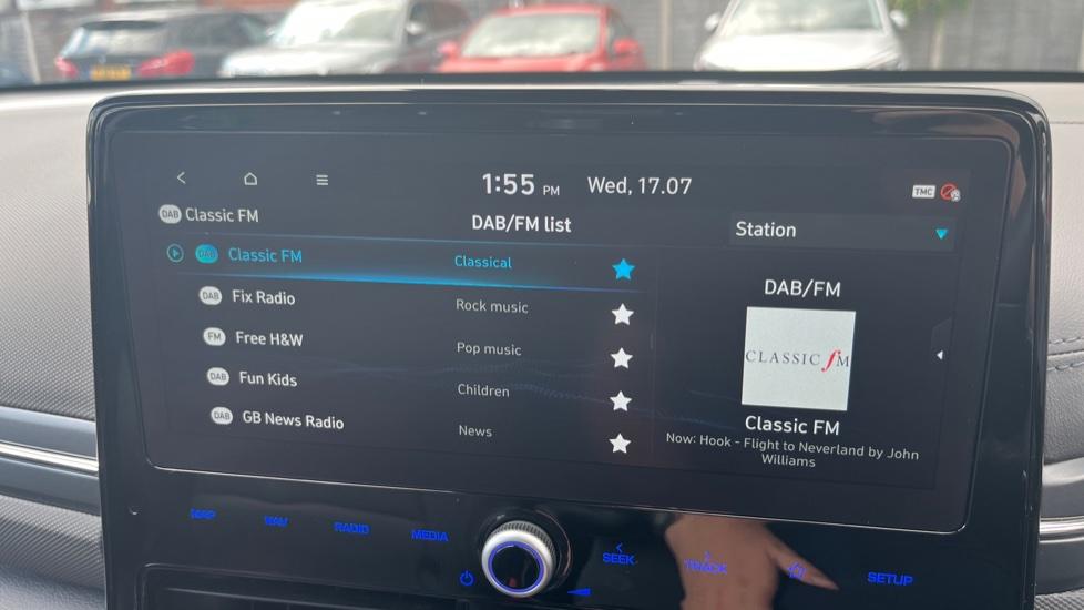 DAB Radio