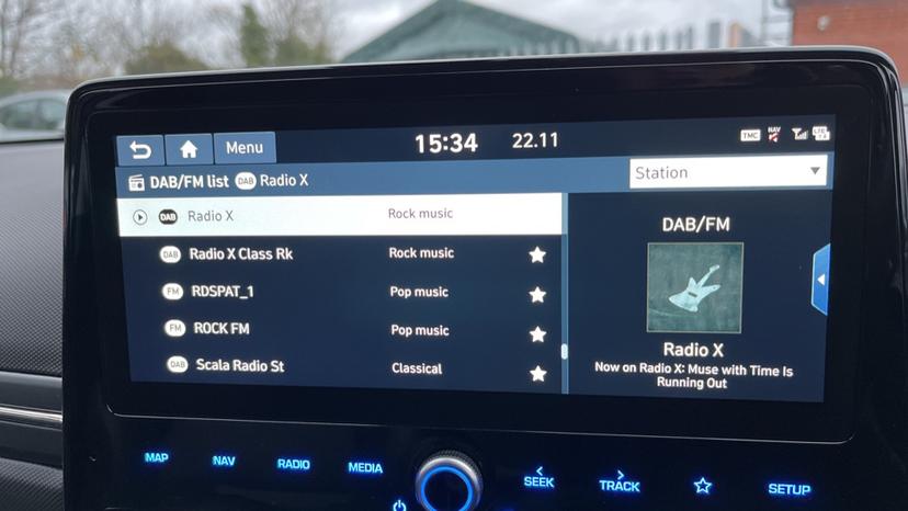 DAB Radio