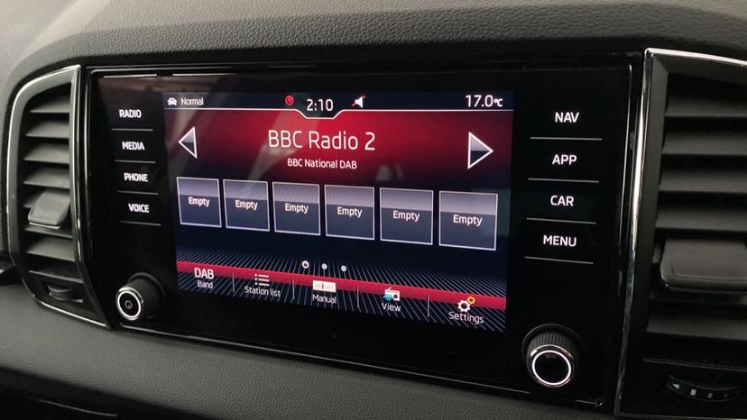 DAB radio 