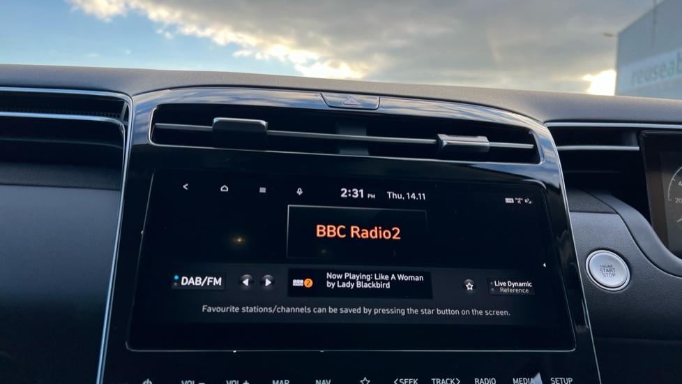 DAB Radio