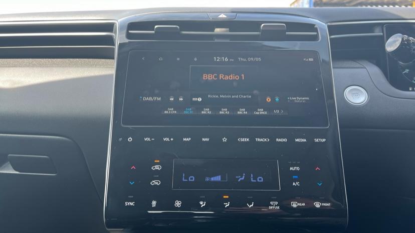 DAB Radio