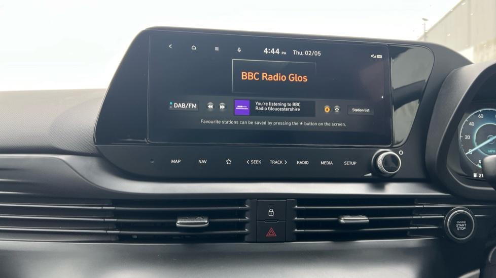 DAB Radio