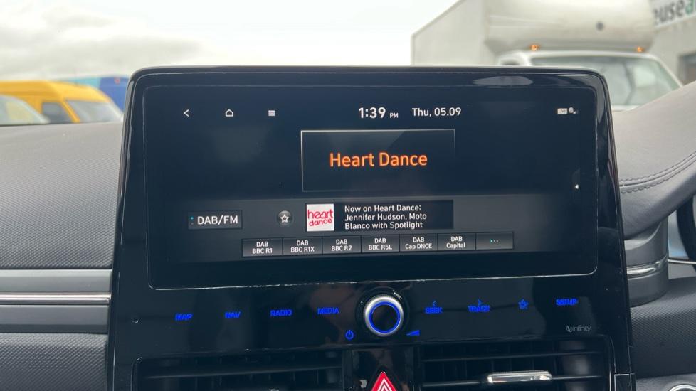 DAB Radio