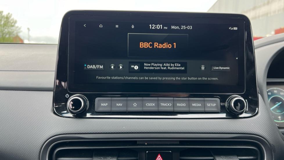 DAB Radio